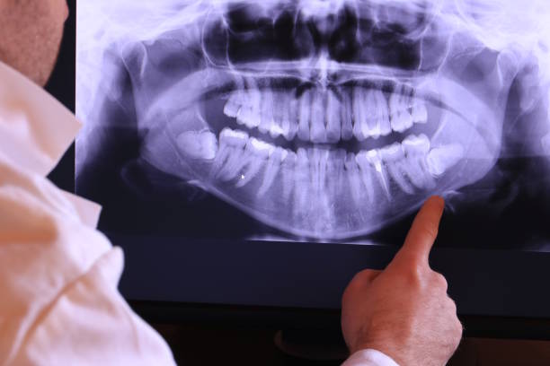  Jamesburg, NJ Emergency Dentist Pros