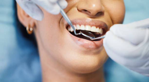 Best Emergency Dentist for Special Needs Patients in Jamesburg, NJ